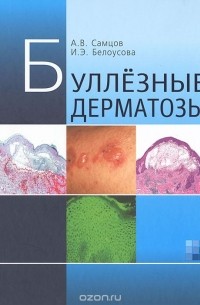 Буллезные дерматозы