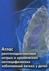 М. Костюченко - Атлас рентгенодиагностики острых и хронических неспецифических заболеваний легких у детей