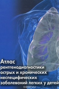 М. Костюченко - Атлас рентгенодиагностики острых и хронических неспецифических заболеваний легких у детей