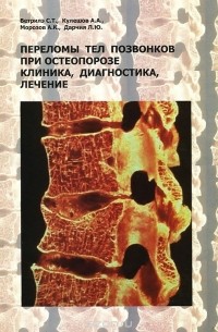  - Переломы тел позвонков при остеопорозе. Клиника, диагностика, лечение