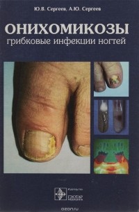 Онихомикозы. Грибковые инфекции ногтей