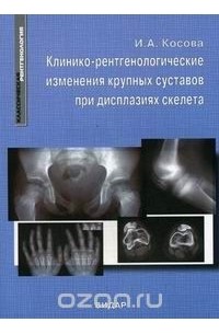 Косова И.А. - Клинико-рентгенологические изменения крупных суставов при дисплазиях скелета