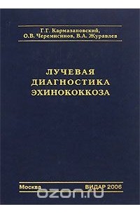  - Лучевая диагностика эхинококкоза