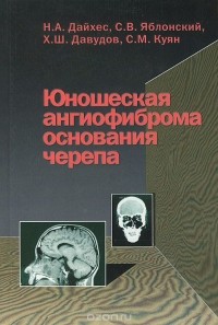  - Юношеская ангиофиброма основания черепа