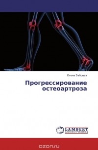 Елена Зайцева - Прогрессирование остеоартроза