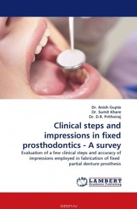  - Clinical steps and impressions in fixed prosthodontics - A survey