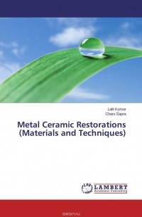  - Metal Ceramic Restorations  (Materials and Techniques)