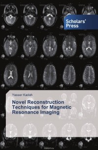 Yasser Kadah - Novel Reconstruction Techniques for Magnetic Resonance Imaging