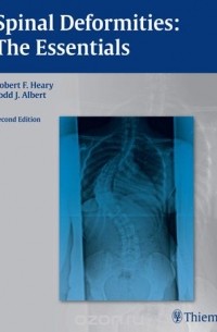 Spinal Deformities: The Essentials