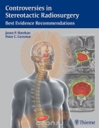  - Controversies in Stereotactic  Radiosurgery: Best Evidence Recommendations