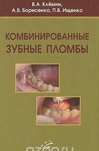  - Комбинированные зубные пломбы