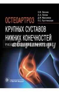  - Остеоартроз крупных суставов нижних конечностей. Руководство для врачей первичного звена