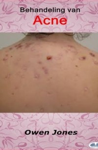 Owen Jones - Behandeling Van Acne