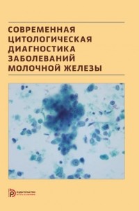 Надежда Волченко - Современная цитологическая диагностика заболеваний молочной железы