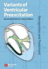 Eduardo Sternick Back - Variants of Ventricular Preexcitation