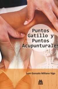 Puntos gatillo y puntos acupunturales