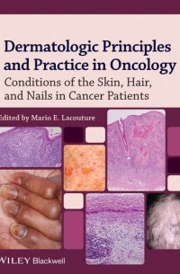 Dermatologic Principles and Practice in Oncology. Conditions of the Skin, Hair, and Nails in Cancer Patients