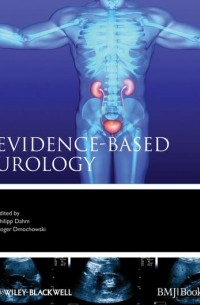 Evidence-based Urology