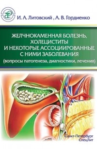 Желчнокаменная болезнь, холециститы и некоторые ассоциированные с ними заболевания