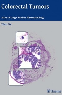 Tibor  Tot - Colorectal Tumors