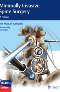 Minimally Invasive Spine Surgery