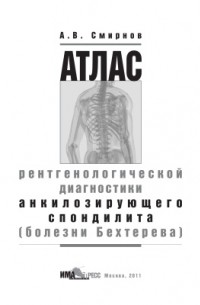 А. В. Смирнов - Атлас рентгенологической диагностики анкилозирующего спондилита (болезни Бехтерева)