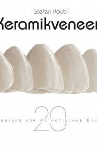 Keramikveneers