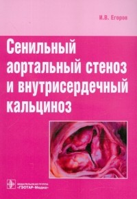 Илья Егоров - Сенильный аортальный стеноз и внутрисердечный кальциноз