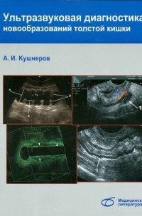 Ультразвуковая диагностика новообразований толстой кишки