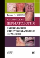 Томас П. Хэбиф - Клиническая дерматология. Акнеподобные и папулосквамозные дерматозы