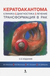 Кератоакантома. Клиника, диагностика, лечение, трансформация в рак