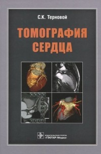  - Томография сердца. Руководство для врачей