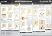  - Плакат "Техника наложения швов" 84х59 см. 