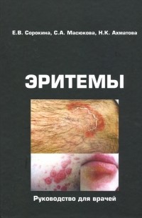  - Эритемы. Руководство для врачей