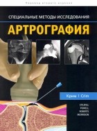  - Артрография
