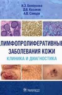  - Лимфопролиферативные заболеванания кожи. Клиника и диагностика