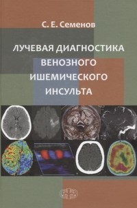 Лучевая диагностика венозного ишемического инсульта