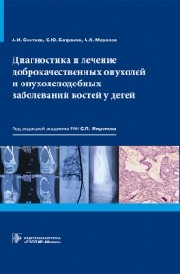  - Диагностика и лечение доброкачественных опухолей и опухолеподобных заболеваний костей у детей