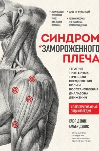 - Синдром «замороженного» плеча. Терапия триггерных точек для преодоления боли и восстановления диапазона движений