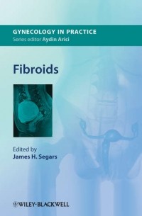 Fibroids