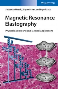 Magnetic Resonance Elastography