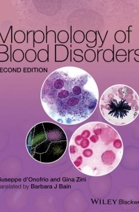 Morphology of Blood Disorders