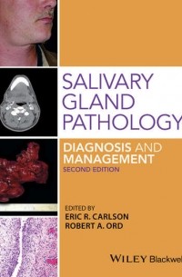 Eric R. Carlson - Salivary Gland Pathology