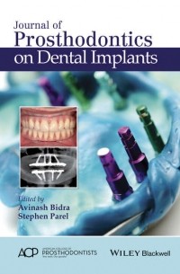 Journal of Prosthodontics on Dental Implants