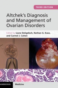 Altchek&apos;s Diagnosis and Management of Ovarian Disorders