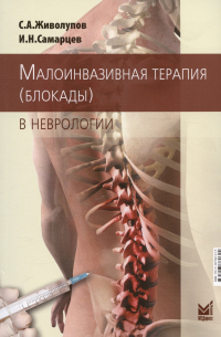 Малоинвазивная терапия (блокады) в неврологии