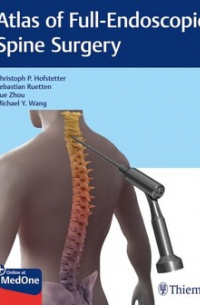 Atlas of Full-Endoscopic Spine Surgery