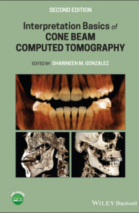 Interpretation Basics of Cone Beam Computed Tomography