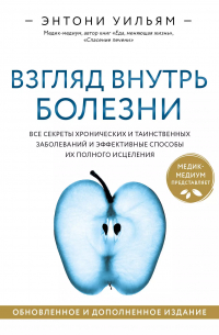 Взгляд внутрь болезни. Все секреты хронических и таинственных заболеваний и эффективные способы их полного исцеления