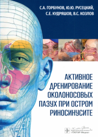  - Активное дренирование околоносовых пазух при остром риносинусите